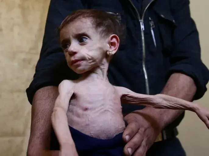 Children in urgent need of food, water and care